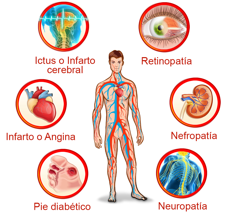 imagen de diferentes complicaciones de la diabetes relacionadas con sistema cardiovascular, riñón, sistema nervioso y visión