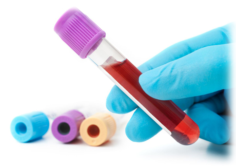 imagen de tubo para análisis de sangre de valores de hemoglobina glicosilada