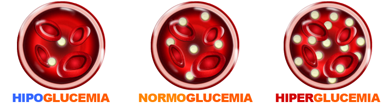 imagen concepto comparativo de hipoglucemia, normo glucemia e hiperglucemia en sangre